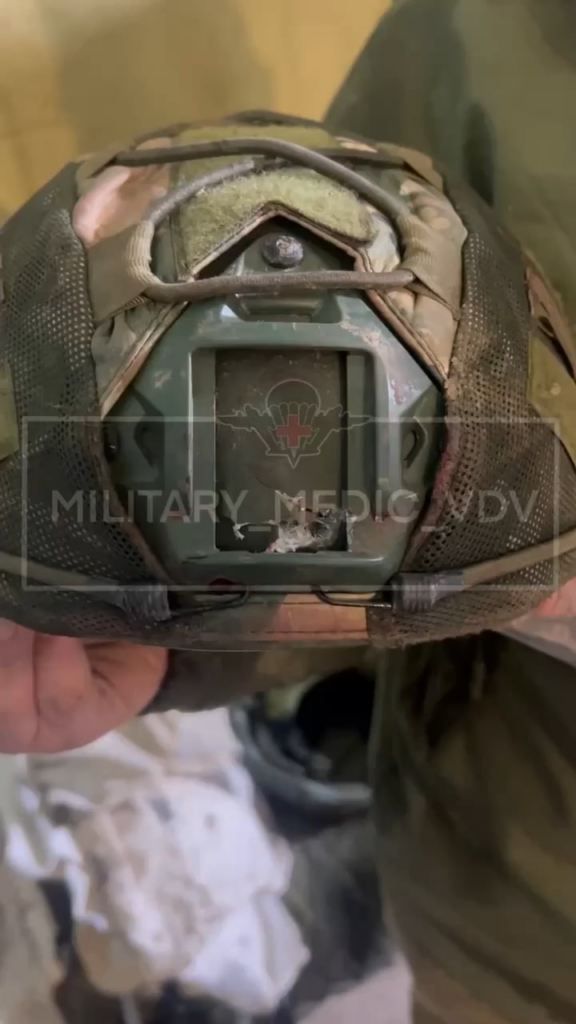 ロシア兵は発射物か破片が頭に当たったが、ヘルメットがそれを止めた。 彼の頭蓋骨にはまだへこみがあり、内出血が問題となる可能性があるため、数日後に経過観察をしたいと考えています。 生々しいものではありませんが、血が少し見えます。