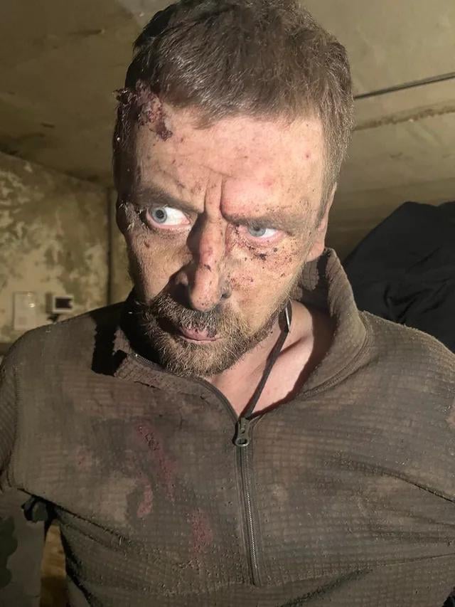 最近アヴディイウカでウクライナ軍に捕らえられたロシア人捕虜。