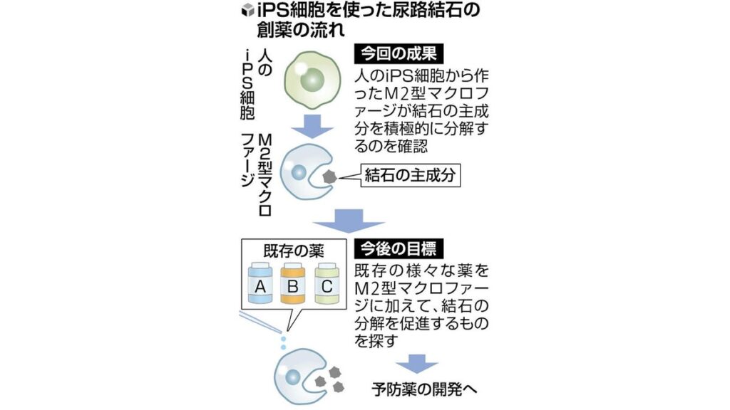 [ニュース] 尿路結石の分解をｉＰＳ細胞で再現…予防薬の開発へ弾み