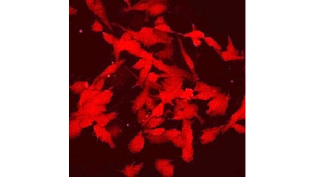 [科学・ＩＴ] 不妊の原因解明につながる成果…ｉＰＳ細胞で前精原細胞や卵原細胞の大量作成技術を確立