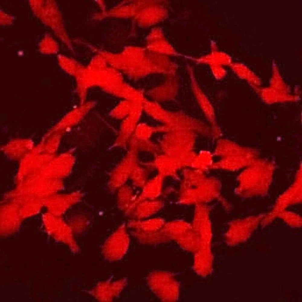 人のｉＰＳ細胞から始原生殖細胞を経て作られた「前精原細胞」（京都大提供）