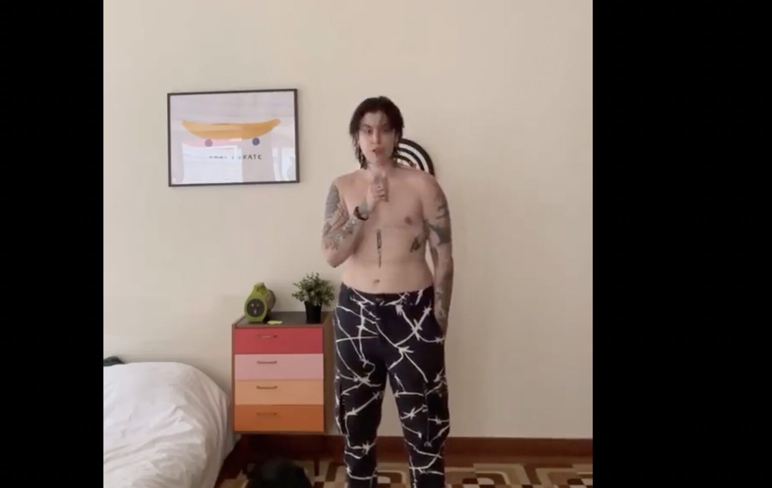 アンドラでの手術で胸を切除したユーチューバーの動画