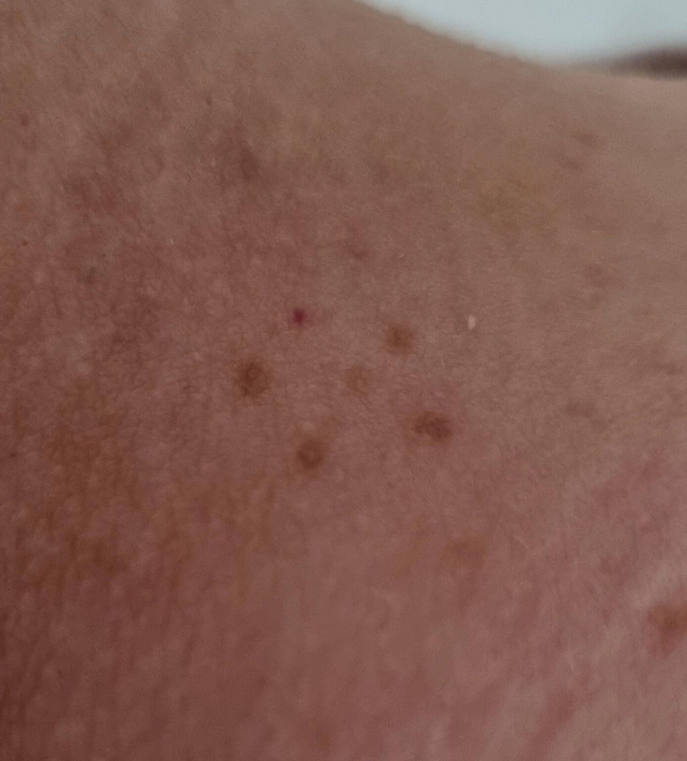 私に星が現れましたか？ 幸運か不運か？