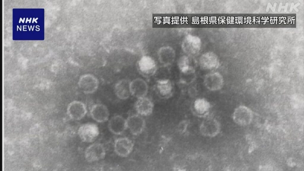 「手足口病」の患者 この時期では過去10年で最多 - nhk.or.jp