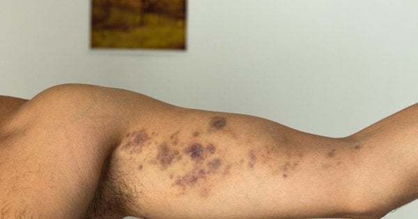 今度はプロブディフで、レストランの警備員による別の暴行。