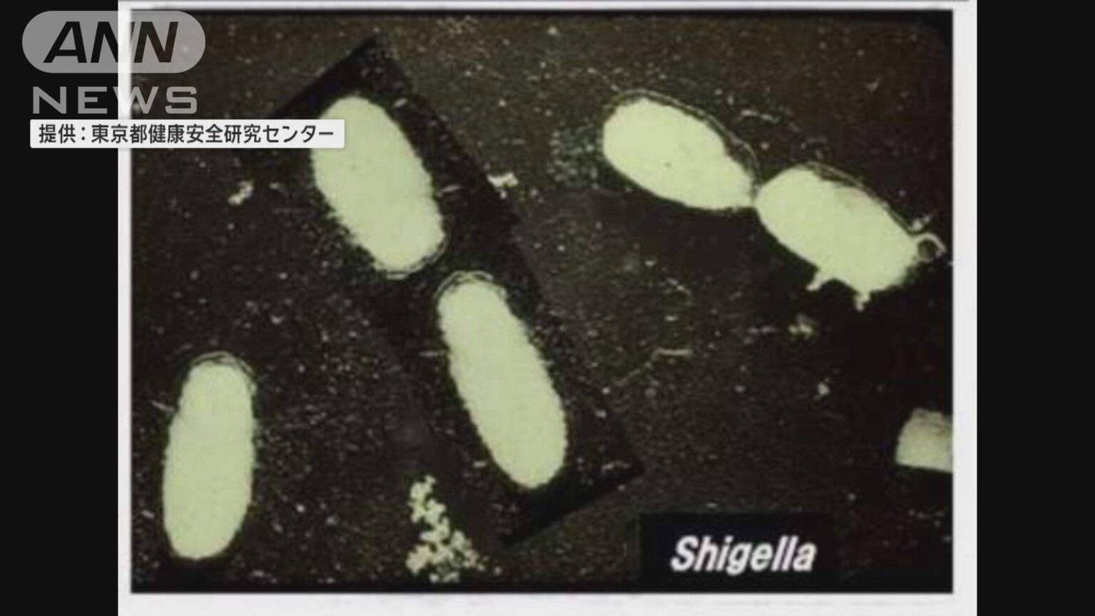 東京・港区赤坂の飲食店で赤痢菌による食中毒 都内の発生は2000年統計開始以来初