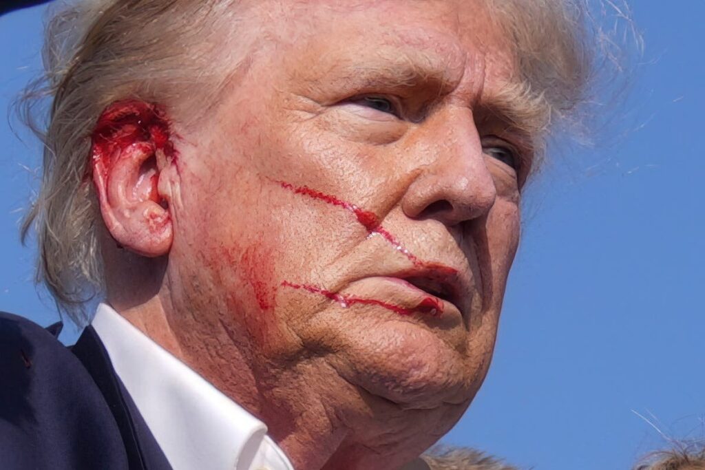 トランプ大統領は自分が「何度も」撃たれるのを見ており、スタッフは彼がPTSDを患っているのではないかと懸念している：報道