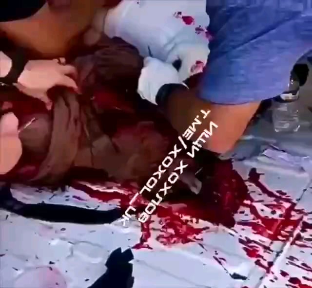 アメリカ人ボランティアがクルスク戦線で腕を失う