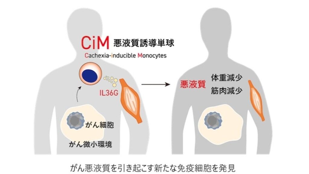 世界初、がん患者の痩せの原因となる免疫細胞を発見 ＝ 東京薬科大学と立命館大学