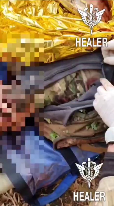 数カ所の傷を負ったロシア兵は屋外で治療を受ける準備をしており、大声で叫んでいる（画像）