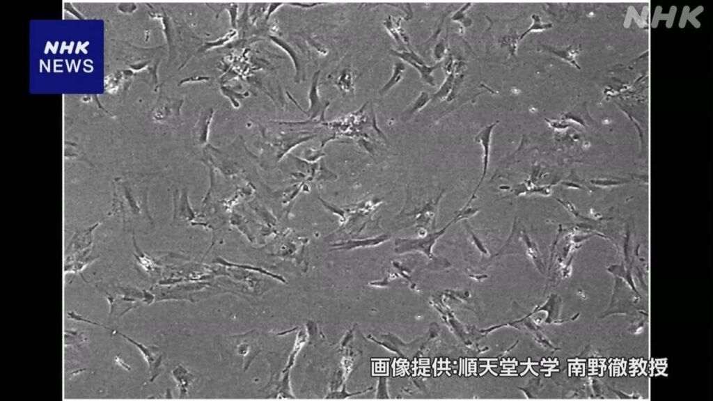 「老化細胞」を薬で取り除く臨床研究、順天堂大など学内申請へ