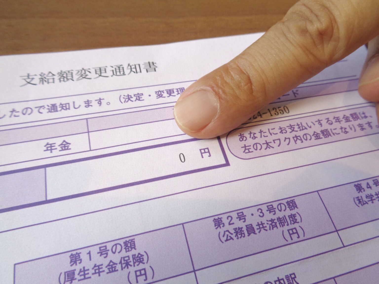 眼球使用困難症候群の患者、障害年金「相次ぎ不支給に」 医師により判定にばらつき