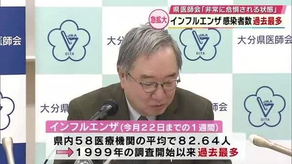 インフルエンザ感染者数　1999年の調査開始以降最多に　県医師会「非常に危惧される状態」大分｜FNNプライムオンライン