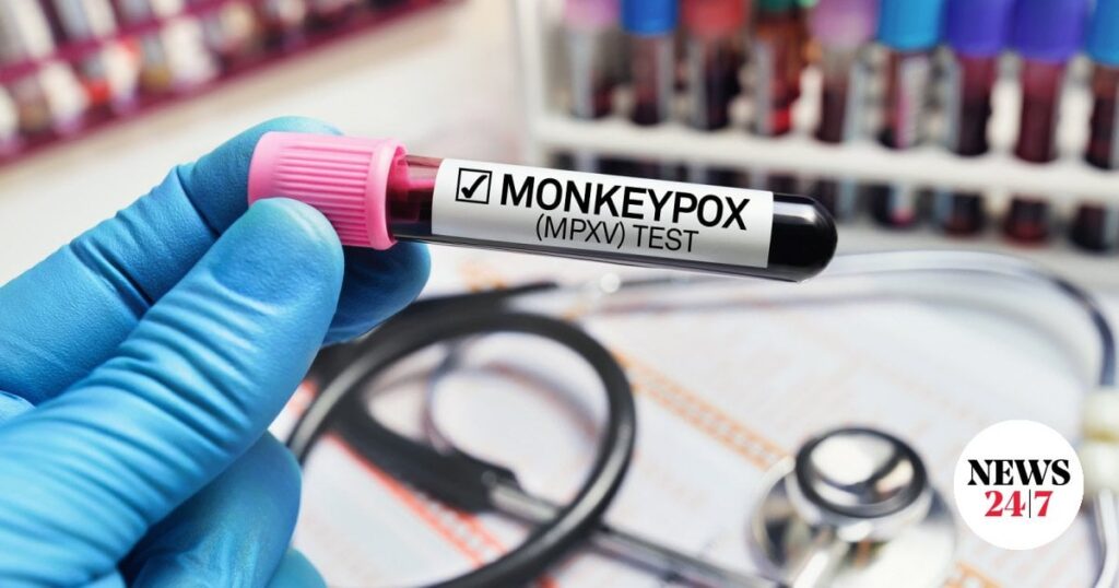 サル痘（mpox）: EODY は感染者数の増加を懸念している
