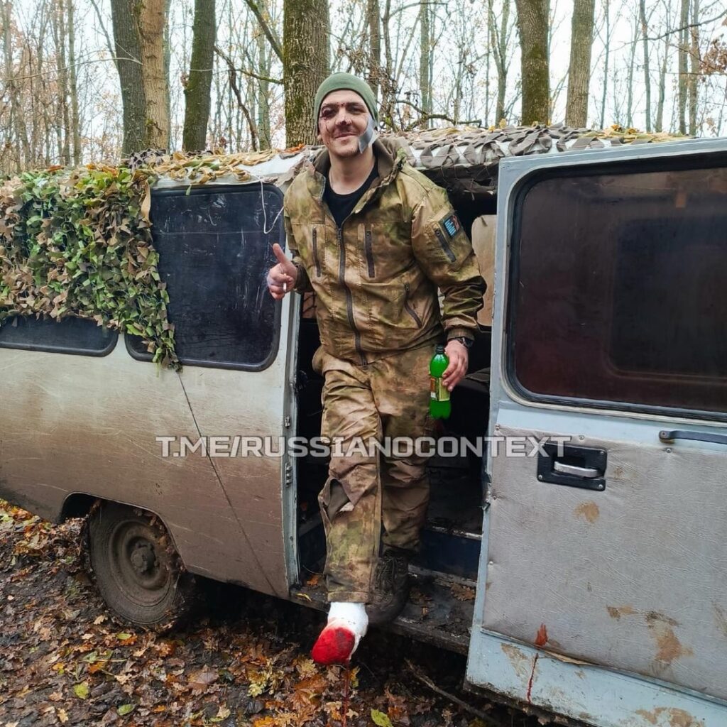 足を吹き飛ばされ、感染したロシアの兵士は、戦争からようやく帰国できて喜ぶ