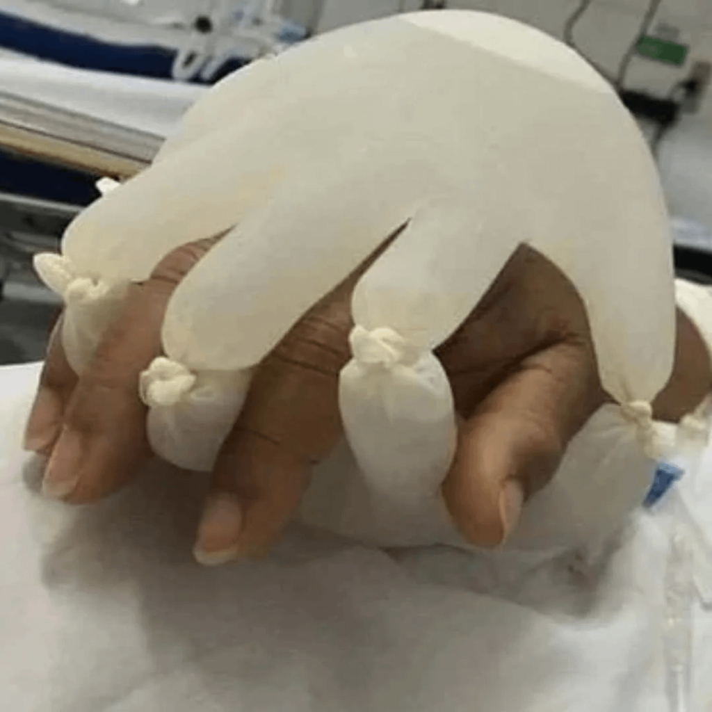 【全米が泣いた】ナースさんの手のぬくもり