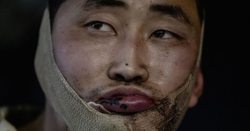 写真はロシアのために戦った後に捕らえられた北朝鮮兵士を示している