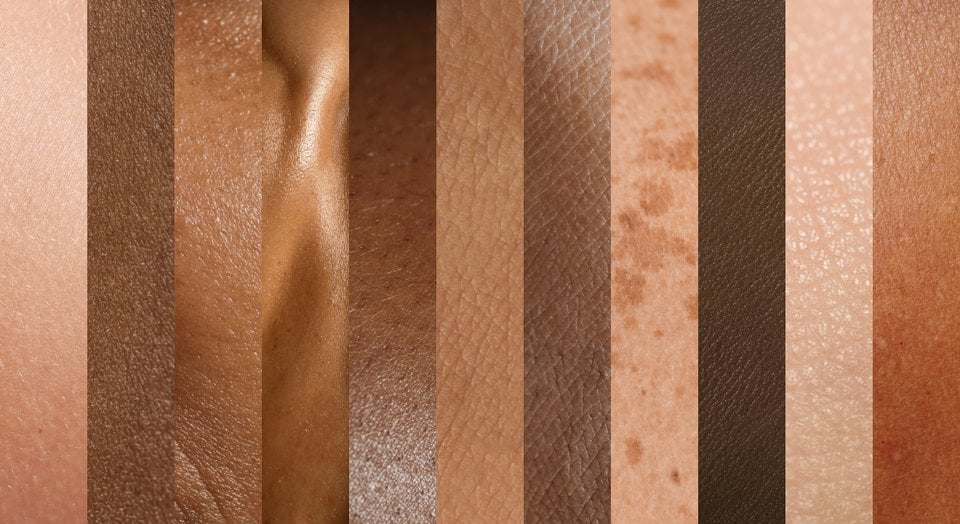 科学者は謎の致命的な皮膚病を治療する [Toksisk epidermal nekrolyse] 最先端のテクノロジーを搭載 |コペンハーゲン大学 - 健康科学部