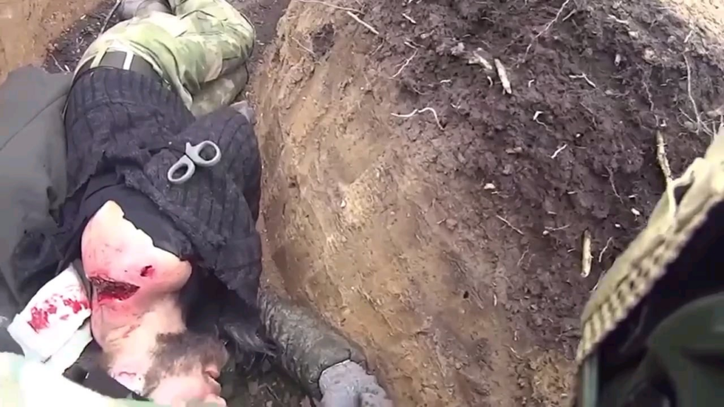 ウクライナ軍による正確な攻撃後のロシア侵略者の最後の映像。彼の仲間のうち2人が負傷し、もう1人はKIAとみられる。数分後、負傷者とともにカメラマン自身も銃撃にさらされた。