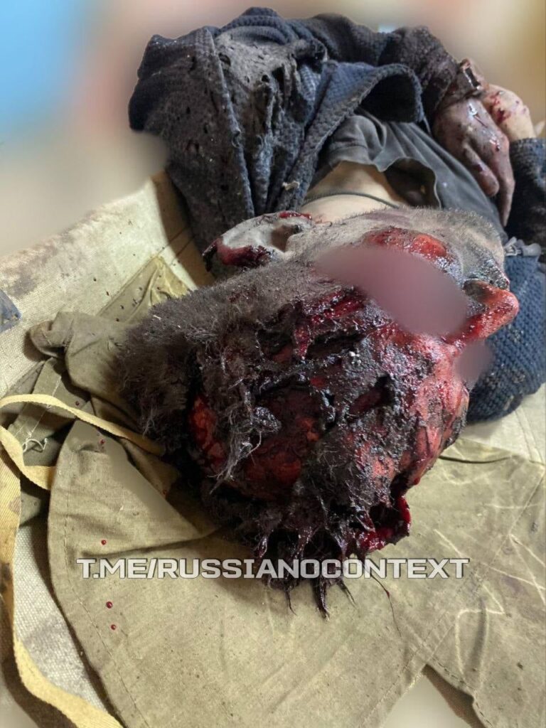 ロシア側はATACMS攻撃後の第810旅団の負傷兵だと主張している。出典: RussiaNoContext [Graphic]