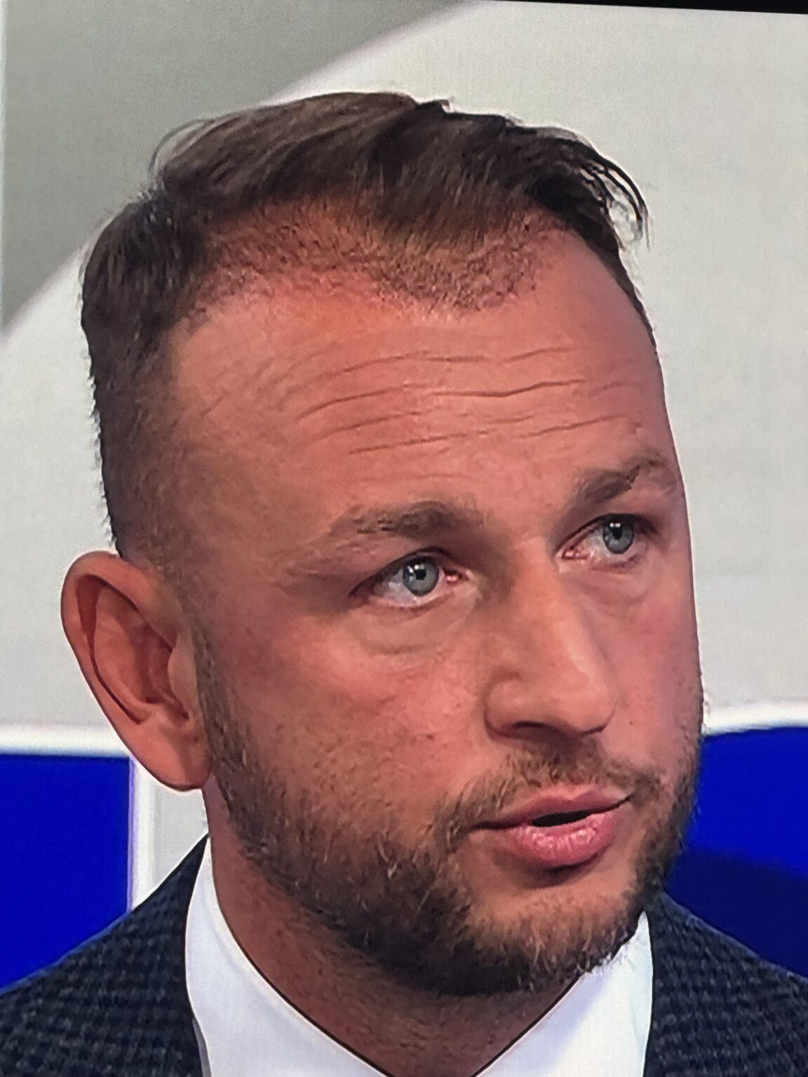 トルコのヘアライン？