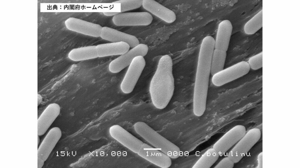 『ボツリヌス菌』による食中毒 要冷蔵食品を常温保管し食べたか 50代女性が重症も回復傾向に 1982年以降、新潟市では初確認