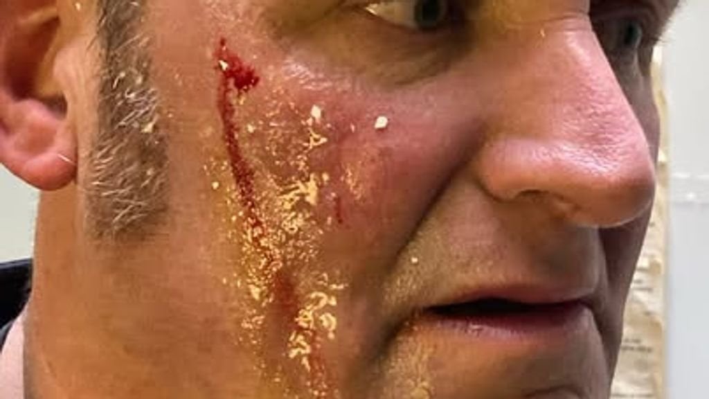 男（22）がゼーランドでサイクリストに卵を投げたとして逮捕された