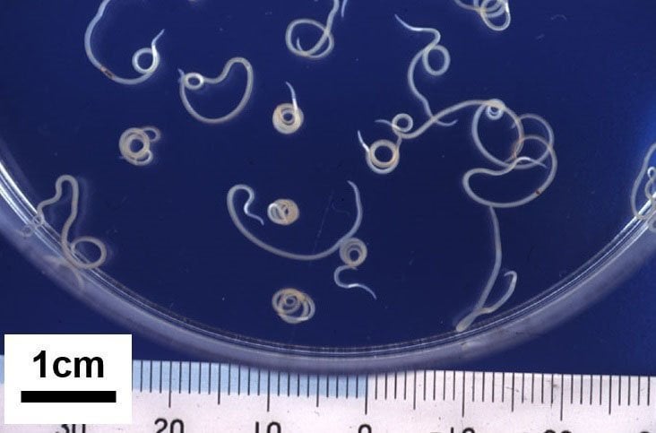 ヒラメ刺し身で食中毒…男性が腹痛症状、アニサキス確認 福井県小浜市
