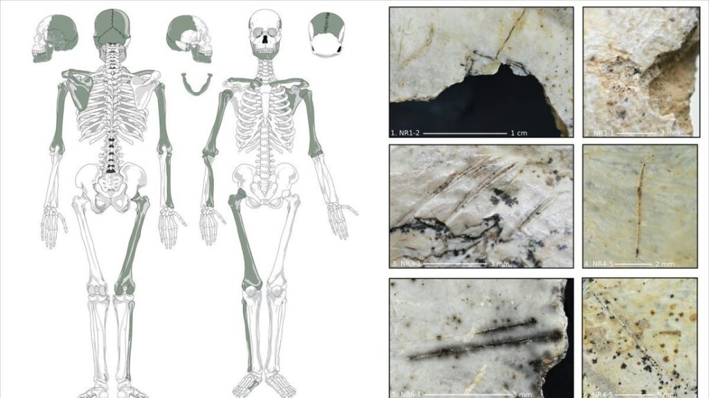 古代欧州人、敵の脳をすくって食べていた可能性　考古学調査で痕跡発見 - CNN.co.jp