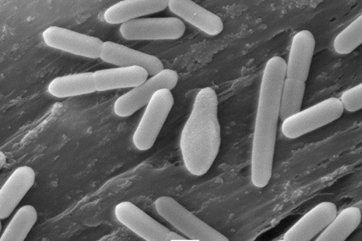 「ボツリヌス菌」で新潟市の女性が重い食中毒 「要冷蔵」を常温保存、ブルーチーズのような味やにおい - 新潟日報デジタルプラス