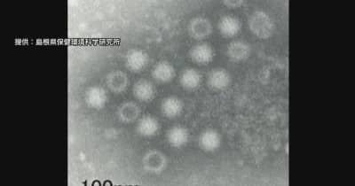 「わずかな量でも感染…」急増するノロウイルスによる食中毒「アルコール消毒は効果薄」対策の難しさ浮き彫り