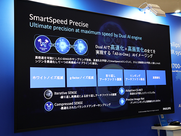 All-in-OneのAIイメージング「SmartSpeed Precise」を新リリース