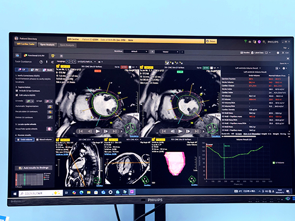 「Advanced Visualization Workspace」には心臓MR解析を統合した「MR Cardiac suite」などが追加