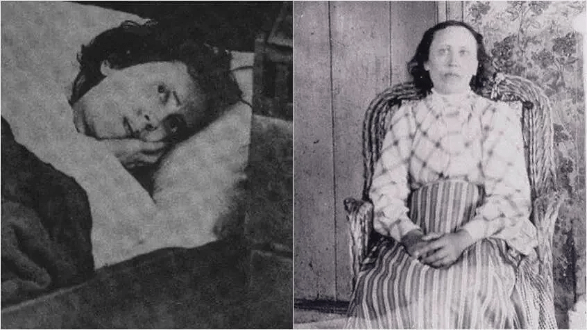 1876年、14歳のカロリナオルソンは、スウェーデンのオクノの村にある自宅で寝て、32年間眠り続け、医師を困惑させ、一般の人々を魅了しました。 （コメントのストーリー）