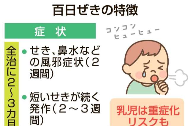 非常に強い感染力…「百日ぜき」県内感染者増加 過去最多ペース、ワクチン、手洗いで予防｜秋田魁新報電子版 - 秋田魁新報電子版