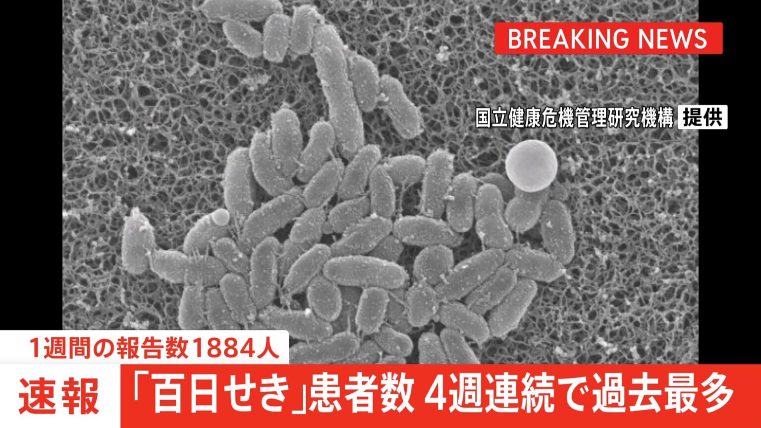 【速報】「百日せき」全国の1週間の報告数1884人　4週連続過去最多（TBS NEWS DIG Powered by JNN）