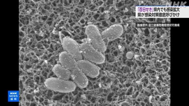 「百日せき」 岩手県内でも感染拡大 感染者が過去最多に｜NHK 岩手県のニュース