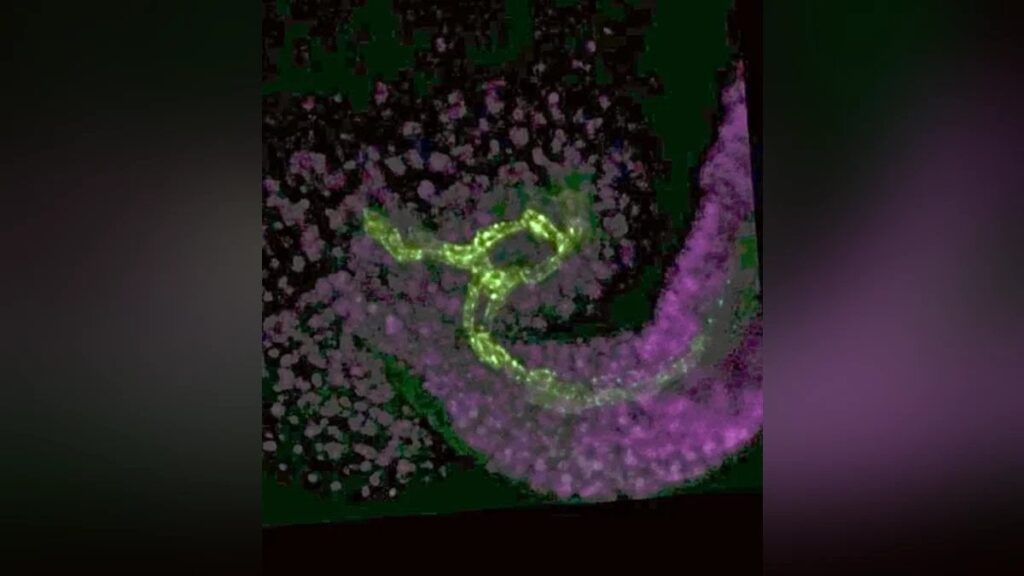 植物にも「へその緒」…受精後に種子へ栄養を送る機能、名古屋大などのチームが新組織を発見