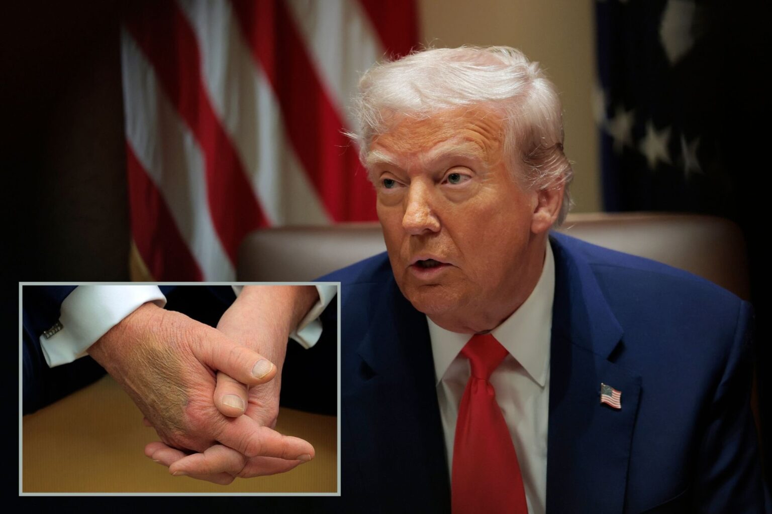 トランプの5時間近くの身体検査は、大規模なあざの物語の後に彼の健康について疑問を投げかけます