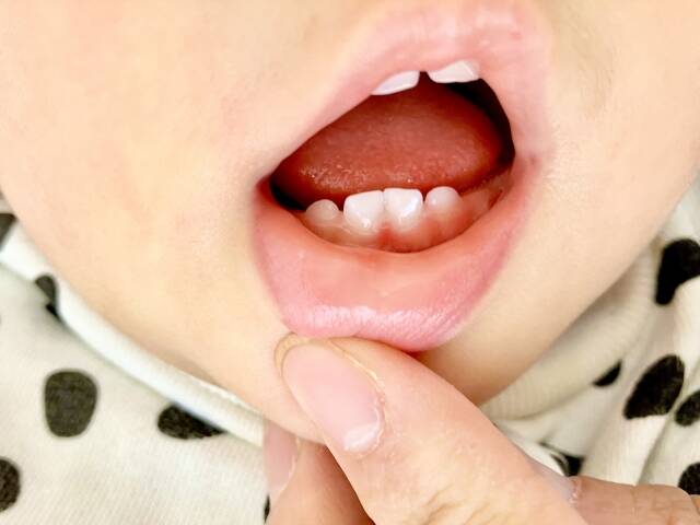 むし歯は感染する?家族がむし歯だと子どももなるってホント?【歯科医が回答】 – with class -講談社公式 むし歯は感染する?家族がむし歯だと子どももなるってホント?【歯科医が回答】 - with class -講談社公式