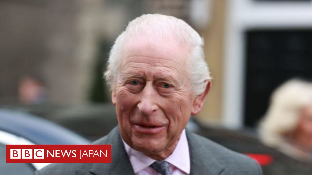 チャールズ英国王、がん治療の一時的副作用を経験 - BBC