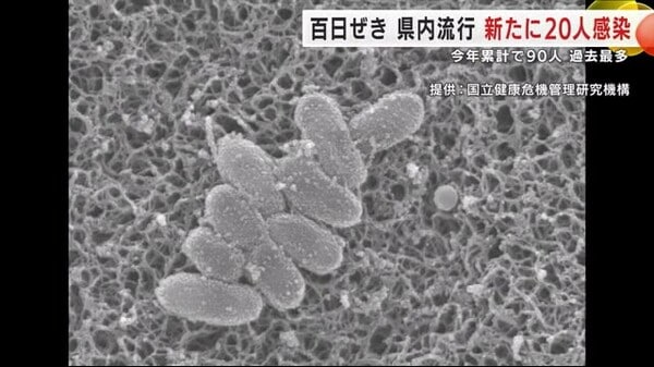百日ぜき 岩手県内で流行　新たに20人感染確認　2025年累計で90人過去最多　｜FNNプライムオンライン