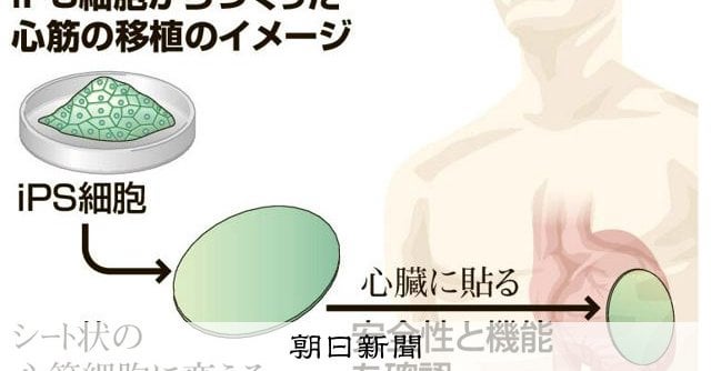 iPS細胞から作った心筋シート、承認申請 世界初の治療に一歩