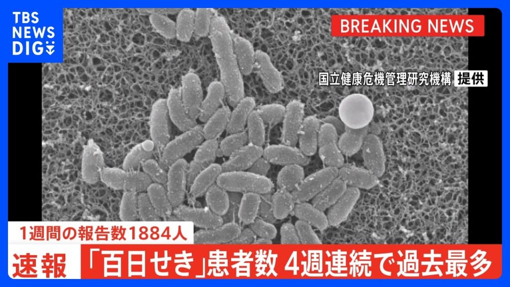 【速報】「百日せき」全国の1週間の報告数1884人　4週連続過去最多｜TBS NEWS DIG
