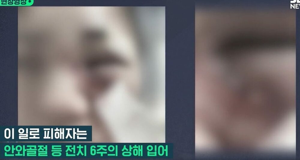 「別れるなら殺して服役する」…韓国「身勝手な」30代男、元交際相手を暴行・監禁、全治6週間　写真枚　国際ニュース：AFPBB News