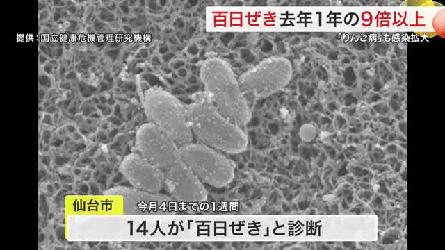 宮城県内の「百日咳」 去年１年間の９倍以上に 「りんご病」も感染拡大（仙台放送） - Yahoo!ニュース