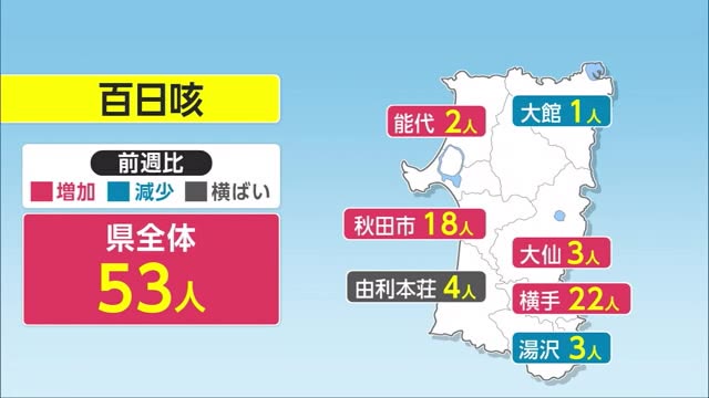 百日咳の感染者数が増加 1週あたり53人で過去最高に 秋田（秋田テレビ） - Yahoo!ニュース