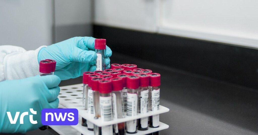ゲントのHIVリファレンスセンターは、アメリカの補助金で130万ユーロを失い、脅迫された他の大学でも研究| VRT NWS：ニュース