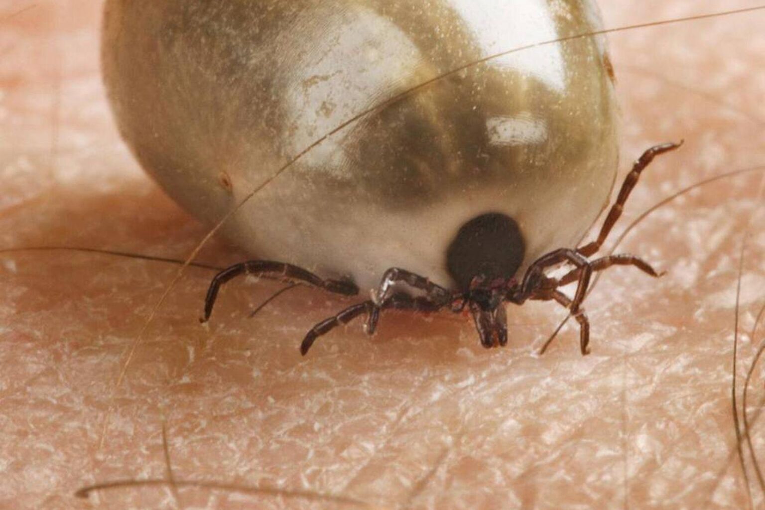 森林ダニに含まれる細菌