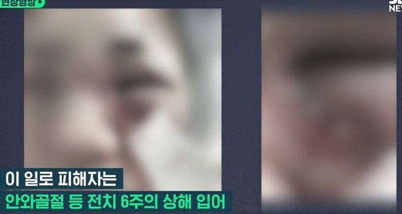 SBS(c)news1